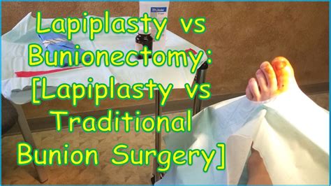 bunionplasty vs lapiplasty